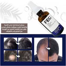 Tired of thinning hair and slow growth? 🌿